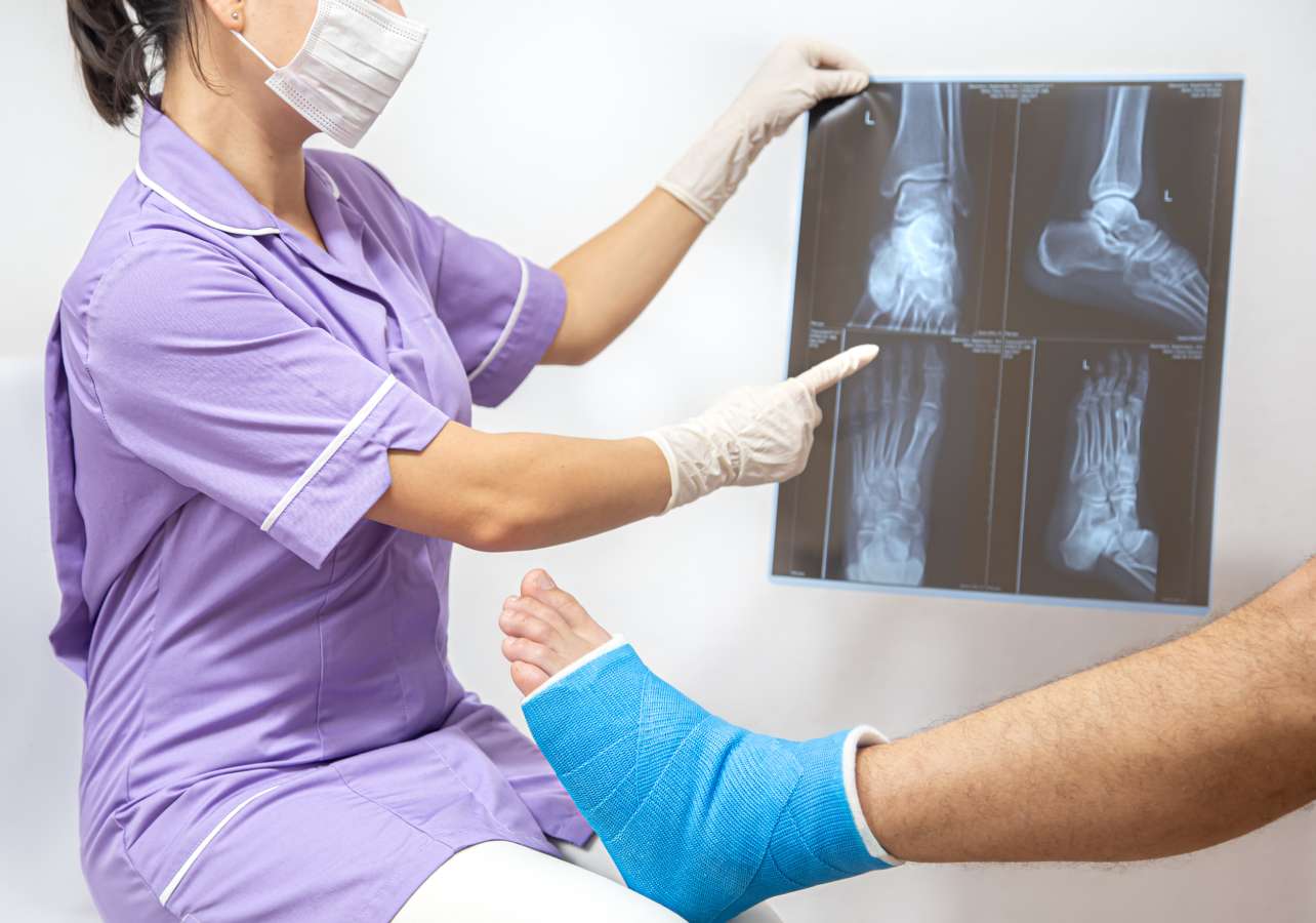 Affordable Knee Replacement in India for International Patients